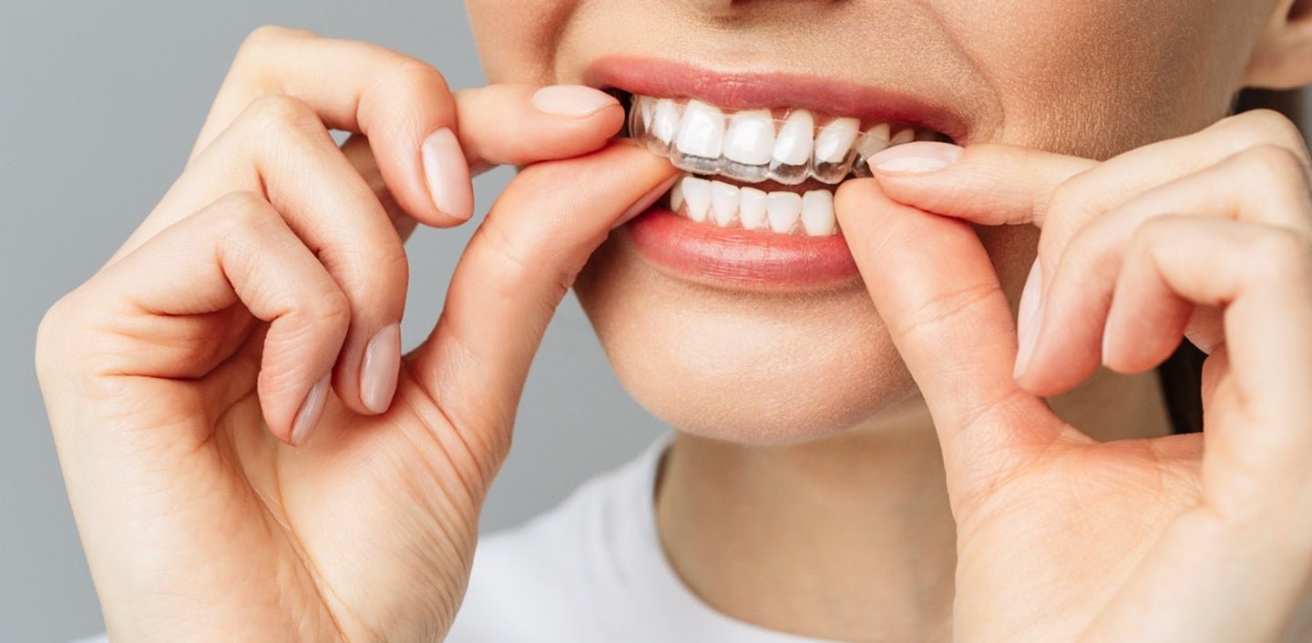 woman with white teeth inserting top clear retainer