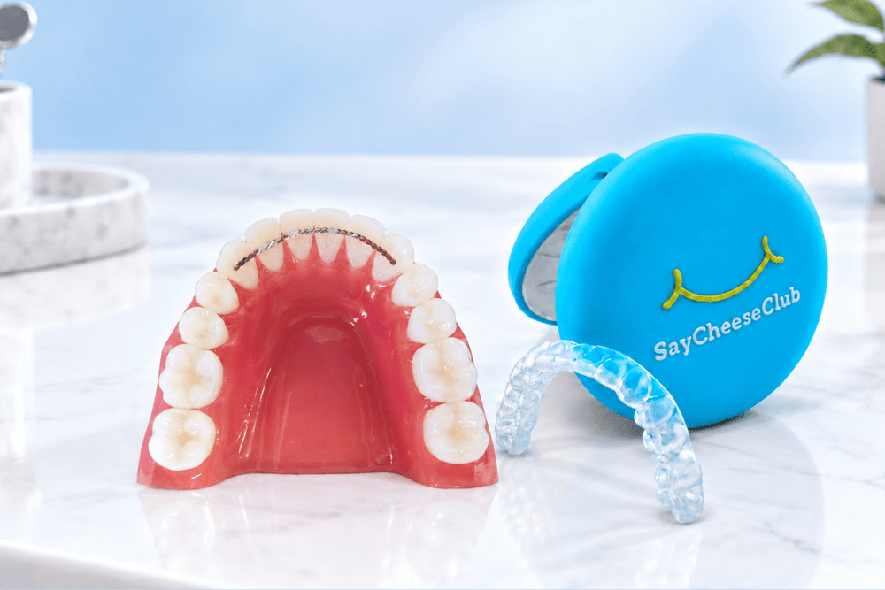 Fixed wire retainer on a dental model beside a clear removable retainer and blue SayCheeseClub retainer case