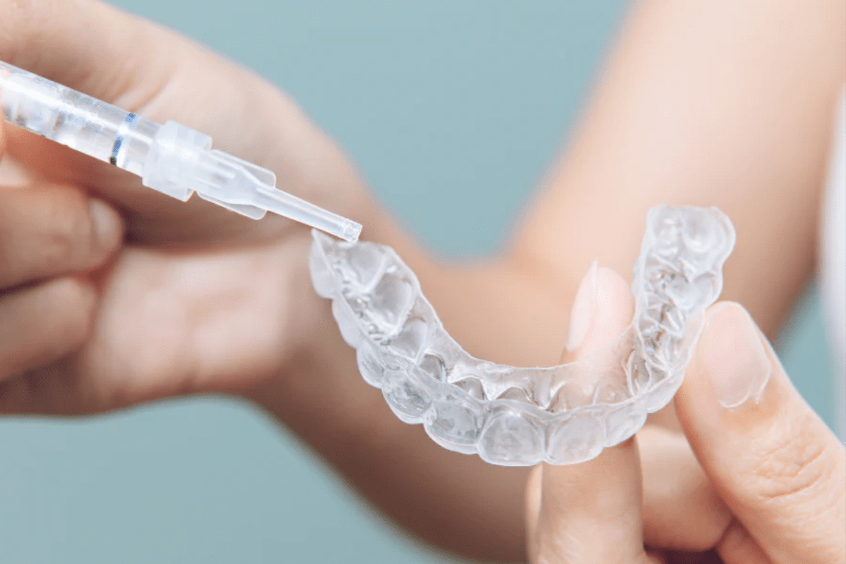 A person applying gel from a syringe to a clear dental aligner held in their hand, set against a soft background.
