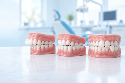 Types of Bite Misalignment: Overbite, Underbite, Crossbite