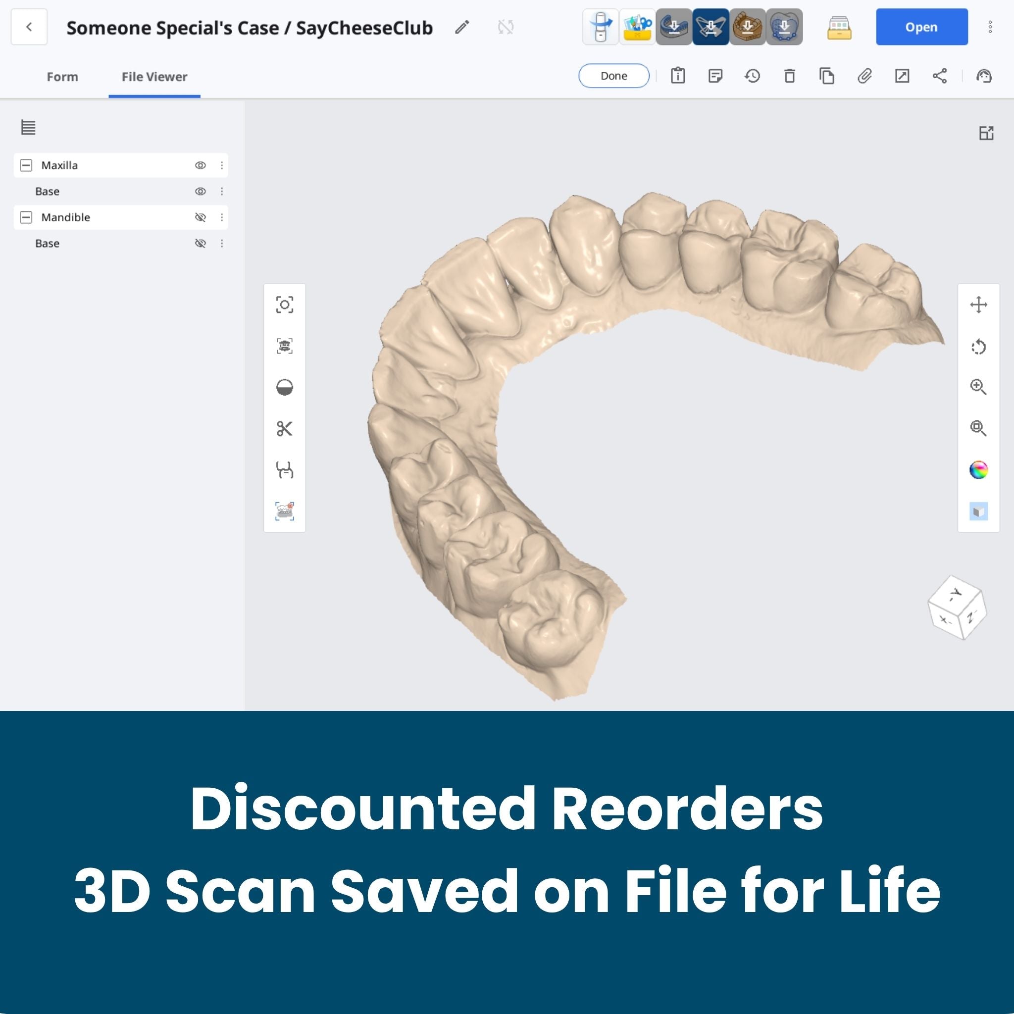 3D scan of clear retainer saved for life