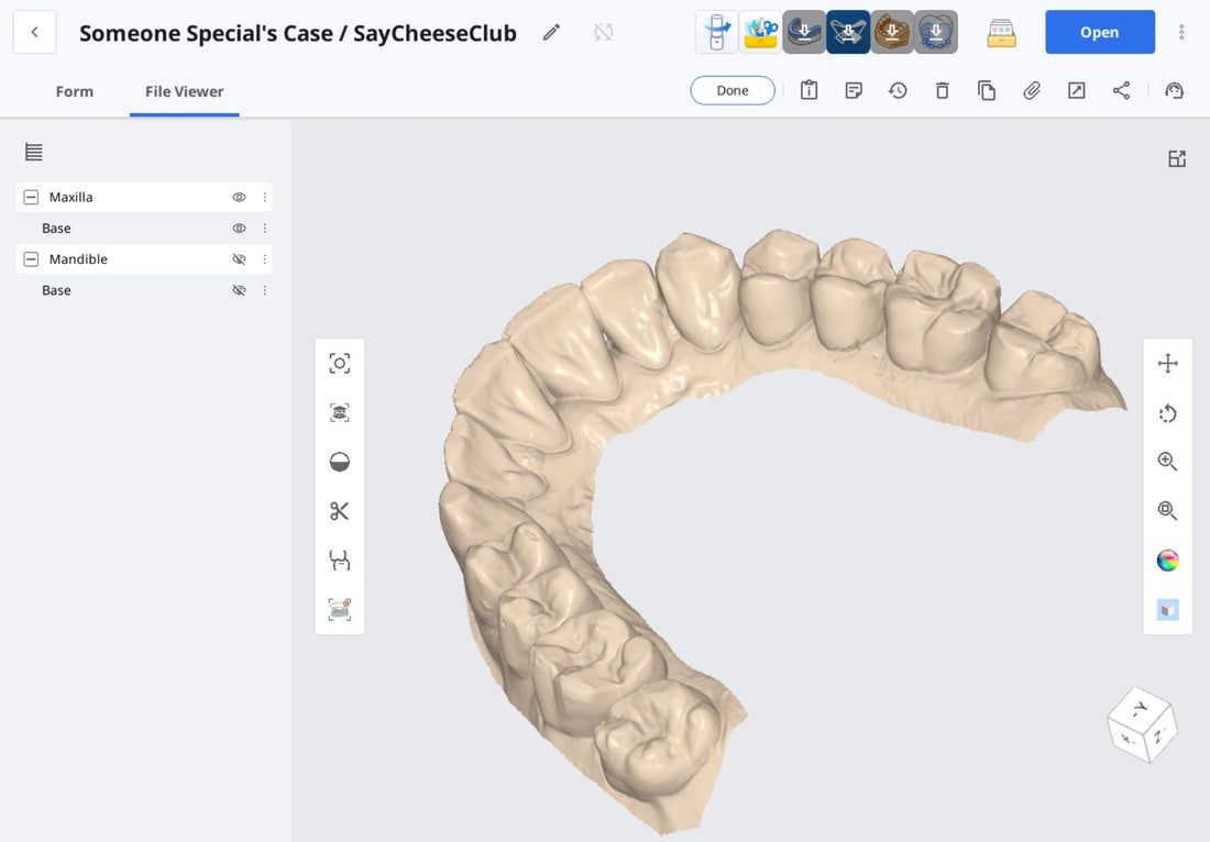 3D scan of clear retainer saved for life