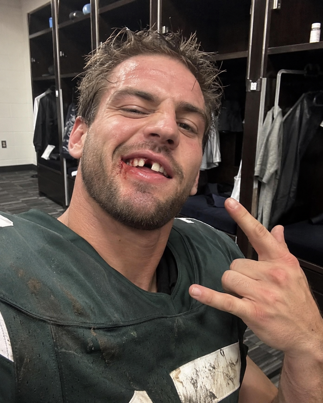 Football player in a locker room with missing front teeth